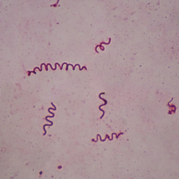 Spirillum Volutans, W.M. Microscope Slide