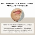 thumbnail image 3 of Sérum facial SKIN1004 Madagascar Centella Asiatica 100 ml, 3 of 5