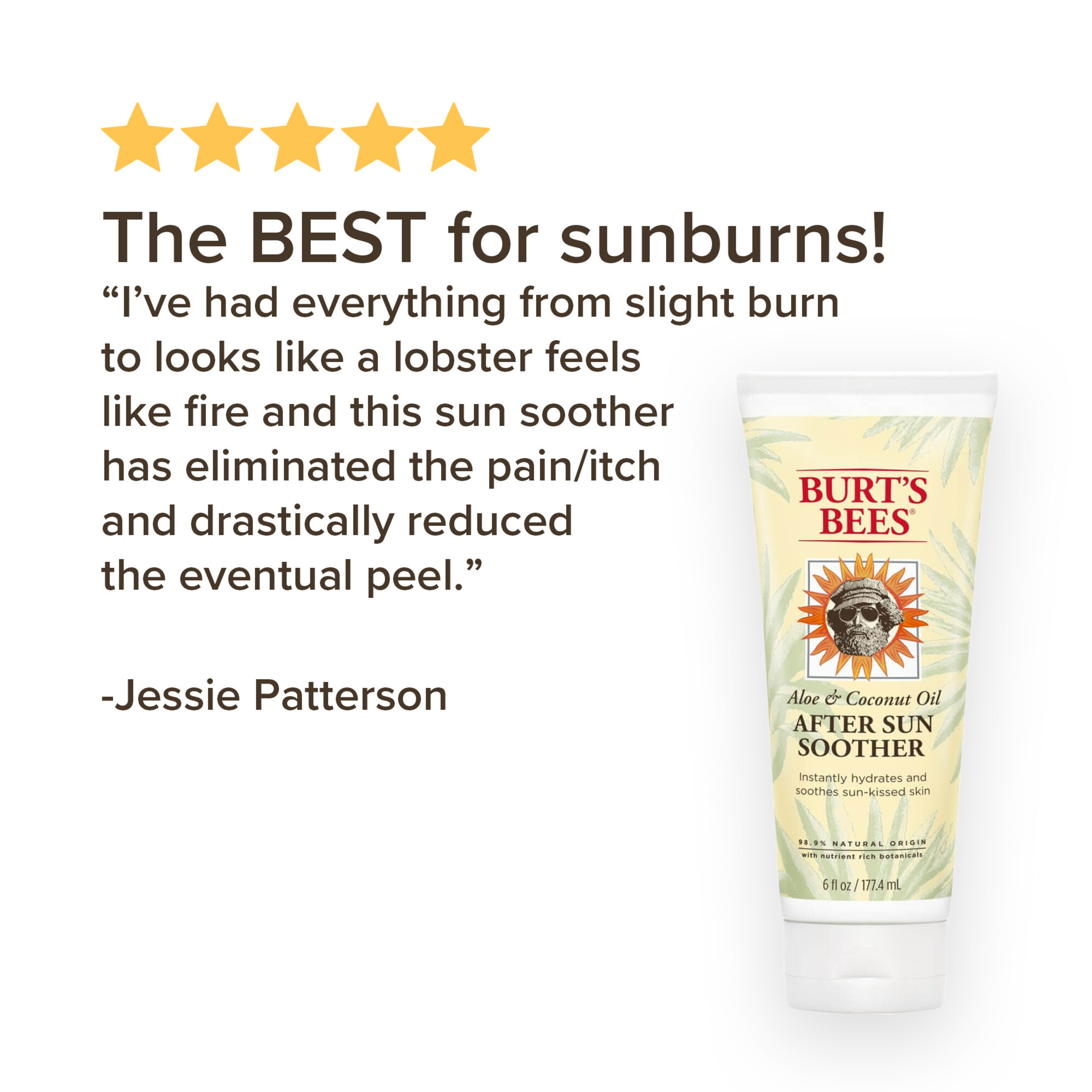Burt's Bees Aloe & Coconut Oil After-Sun Soother, 6 Oz - image 2 of 10