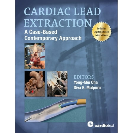 UPC: 9781942909545 | Cardiac Lead Extraction: A Case-Based Contemporary Approach (Paperback)