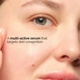 thumbnail image 3 of Sérum The Ordinary Balancing & Clarifying de 30 ml para el control de la grasa, 3 of 4