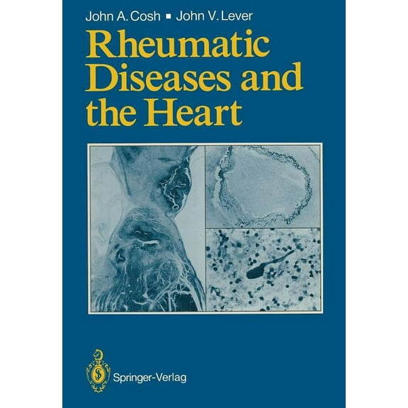 Rheumatic Diseases and the Heart, (Paperback)