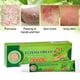 thumbnail image 4 of Eczema Psoriasis Dermatitis Pomada Crema de hierbas Anti Picazón Yeso ANGGREK CB1012, 4 of 7