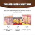 thumbnail image 3 of Jaysuing Anti-white Hair Essence White To Black Hair Essence Scalp Massage Moisturizing Hair Growth Essencev, 3 of 5
