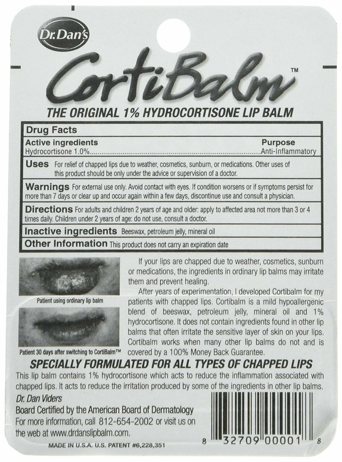 Dr. Dan's CortiBalm Lip Balm Hypoallergenic Cool Sore Relief, 14 Oz, 5 Pack