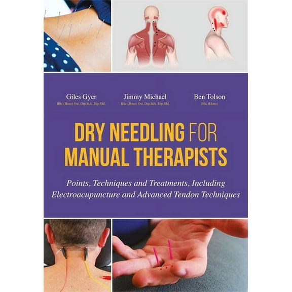 Dry Needling for Manual Therapists: Points, Techniques and Treatments, Including Electroacupuncture and Advanced Tendon , (Hardcover)