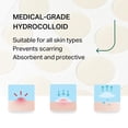 thumbnail image 4 of Parche hidrocoloide para espinillas Y'OUR Parches para acné, 56 unidades, 4 of 5
