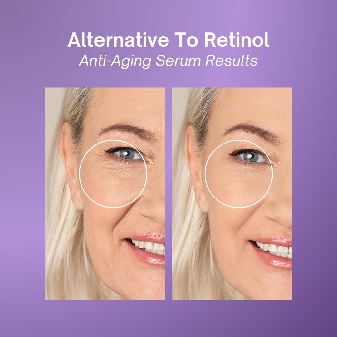 Excuse My Frank Bakuchiol Age Defense Serum, for Smoothing Fine Lines and Wrinkles, Anti Aging,Skin Brightening