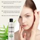thumbnail image 4 of Tónico de aloe vera para exfoliante facial, control de grasa suave, tónico hidratante para pigmentación facial, suero reparador de la piel con vitamina E, 4 of 4