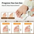thumbnail image 3 of EliaValth Bunion Corrector for Women, Adjustable Big Toe Brace with Knob & Angled Plates, Toe Alignment Support for Hallux Valgus Relief, Medium Size,  Yellow, 1 Pack, 3 of 10