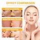 thumbnail image 4 of Cara Desgarrada Mascarilla facial para eliminar el acné de 60 g, limpieza profunda, reduce las líneas finas para todo tipo de piel Likrtyny Cuidado Belleza, 4 of 5