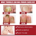 thumbnail image 4 of 1-6pcs EELHOE Toenail Fungus Treatment 50ml Anti Fungal Solution for Fingernails, Nail Repair, Toena, 4 of 5