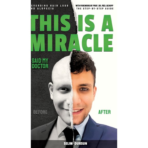 This Is a Miracle Said My Doctor: Reversing Hair Loss and Alopecia, (Hardcover)