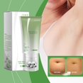 thumbnail image 5 of Openpig Clearance Drainage Roller Waist 60ML Roller Liquid Cream Body Care Xianna Cream Roller Type, 5 of 9