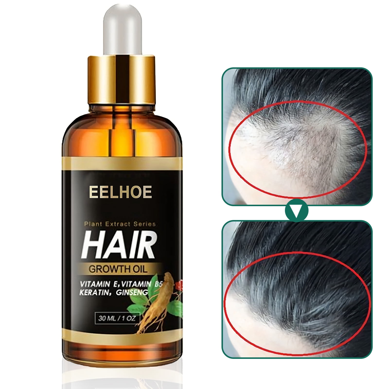 Elecsop Hair Growth Oil, Biotin Hair Growth Serum Hair Loss Treatment for  Promotes Hair Regrowth, Prevent Thinning Hair 
