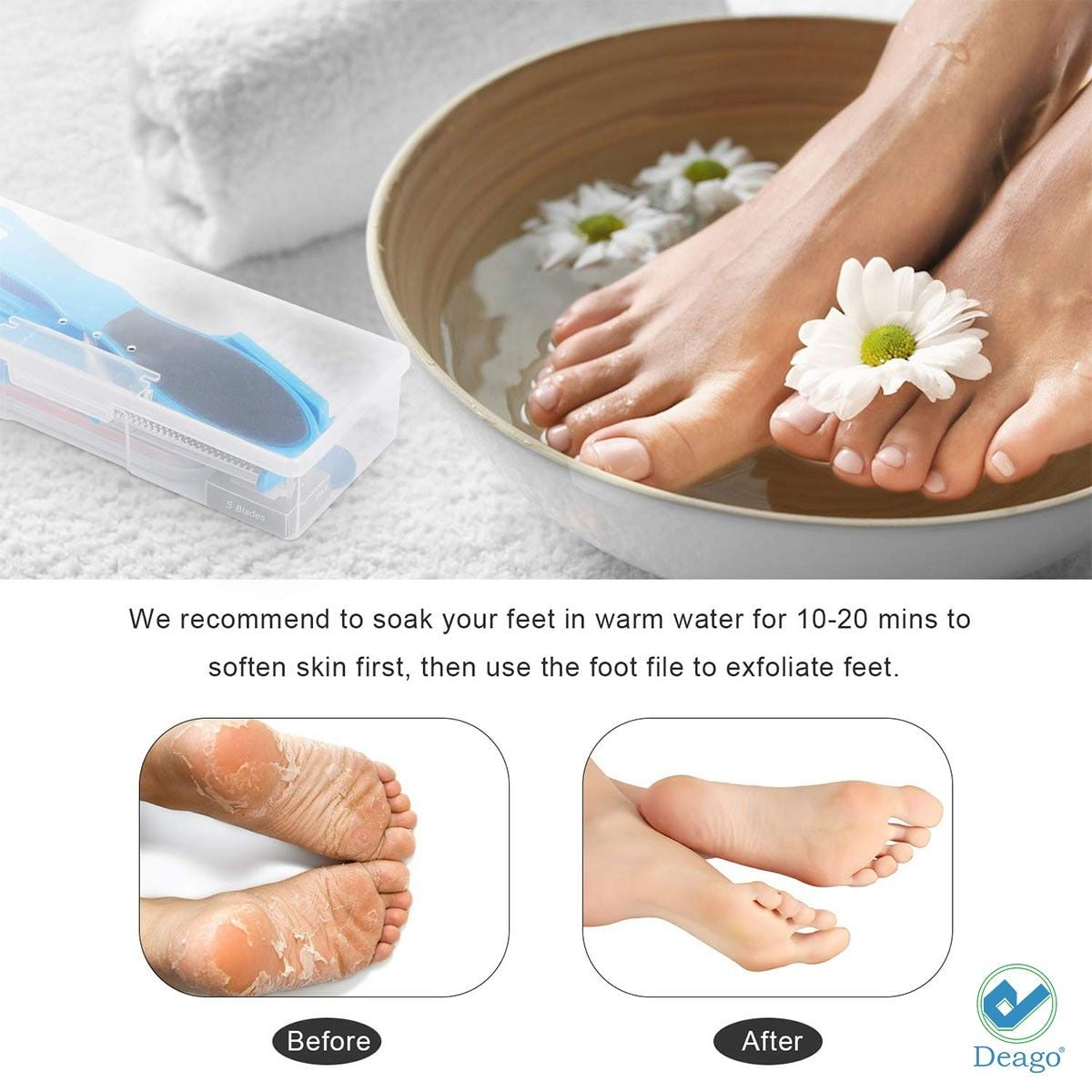 12pcs Pedicure Tools Set/ Foot Care Kit Feet Rasp Dead Skin 