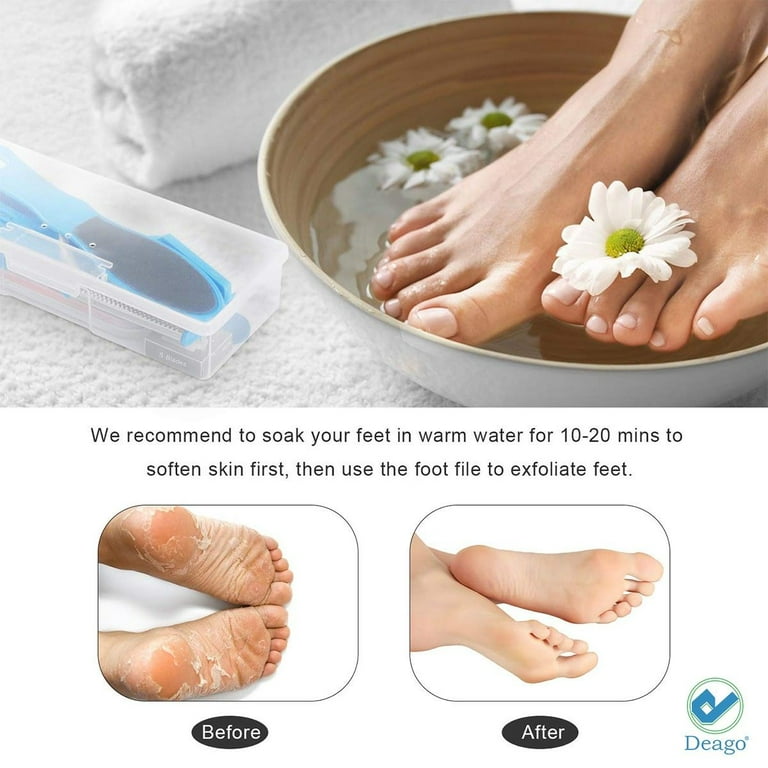 36 in 1 Pedicure Kit, Professional Pedicure Tools Foot Rasp Foot Dead Skin  Remover for Home & Salon Care