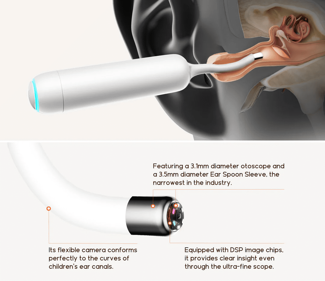 Bebird Home 30S Ear Care Pro