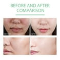 thumbnail image 4 of Exfoliating Gel, Peeling Gel, Purifying Exfoliating Gel, Deep Cleansing Exfoliating Face Scrubber Gel（3Pcs）, 4 of 7