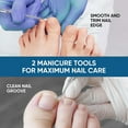 thumbnail image 6 of Ingrown Toenail Correction Kit, 50-Piece with Toenail File & Lifter, 6 of 8
