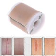 thumbnail image 3 of 4x150cm Removal Silic L Sheet Therapy Patch For Burn Skin Rep 2pcs, 3 of 5