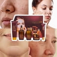 thumbnail image 3 of Set Cuidado Facial UNIVERSOENLÍNEA.COM Caviar Yeast Hidratante para Piel Reseca y Arrugas, 3 of 6
