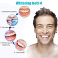 thumbnail image 2 of Teeth Whitening Trays, 20 Pcs Thermoplastic Teeth Trays Thermoforming Teeth Guards Mould Dental Oral Care Kit--, 2 of 4