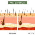 thumbnail image 3 of Luseta Tea Tree & Argan Oil Detangling Shampoo & Conditioner Set, 2 x 33.8 Oz, 3 of 5