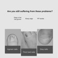 thumbnail image 2 of Multi-functional Nail Clipper Fingernails Toenails Clippers Nail File Ingrown Toenail Tool for Nail Beauty Nail Care Anti-slip Nail Cutter Trimmer, 2 of 4