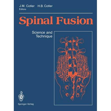 Spinal Fusion : Science and Technique
