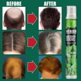 thumbnail image 5 of Sérum en spray de jengibre para el crecimiento del cabello fino y la caída, nutrición profunda del cuero cabelludo, 10 ml, 5 of 5