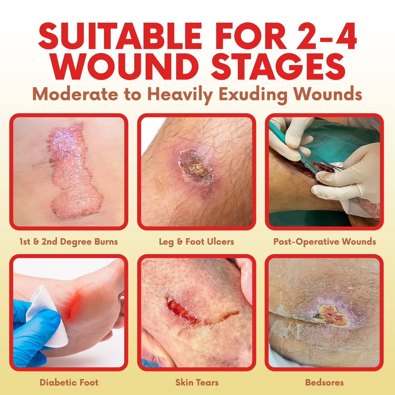 HEALQU Silicone Foam Dressing with Border 4x4 inch, 10-Count Box – Multi-Layer Absorbent, Breathable, Waterproof Pads for Wound Care, Burns, and Pressure Ulcers