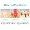 thumbnail image 3 of HairMax Ultima 12 LaserComb Appareil de Croissance Capillaire à Domicile. 12 Lasers de Qualité Médicale. Stimule la Pousse des Cheveux, Inverse l'Amincissement, Repousse des Cheveux Plus Denses, Cheveux Plus Fournis. Traitement Ciblé de la Perte de Cheveux., 3 of 8