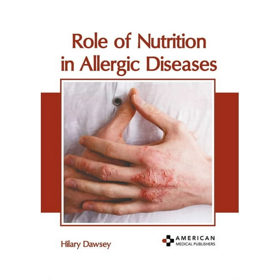 Role of Nutrition in Allergic Diseases, (Hardcover)