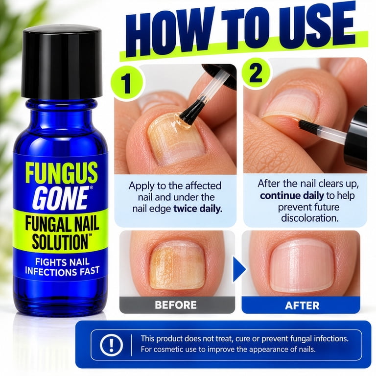 Nail-Aid Fungus Gone Maximum Strength Serum photo 8