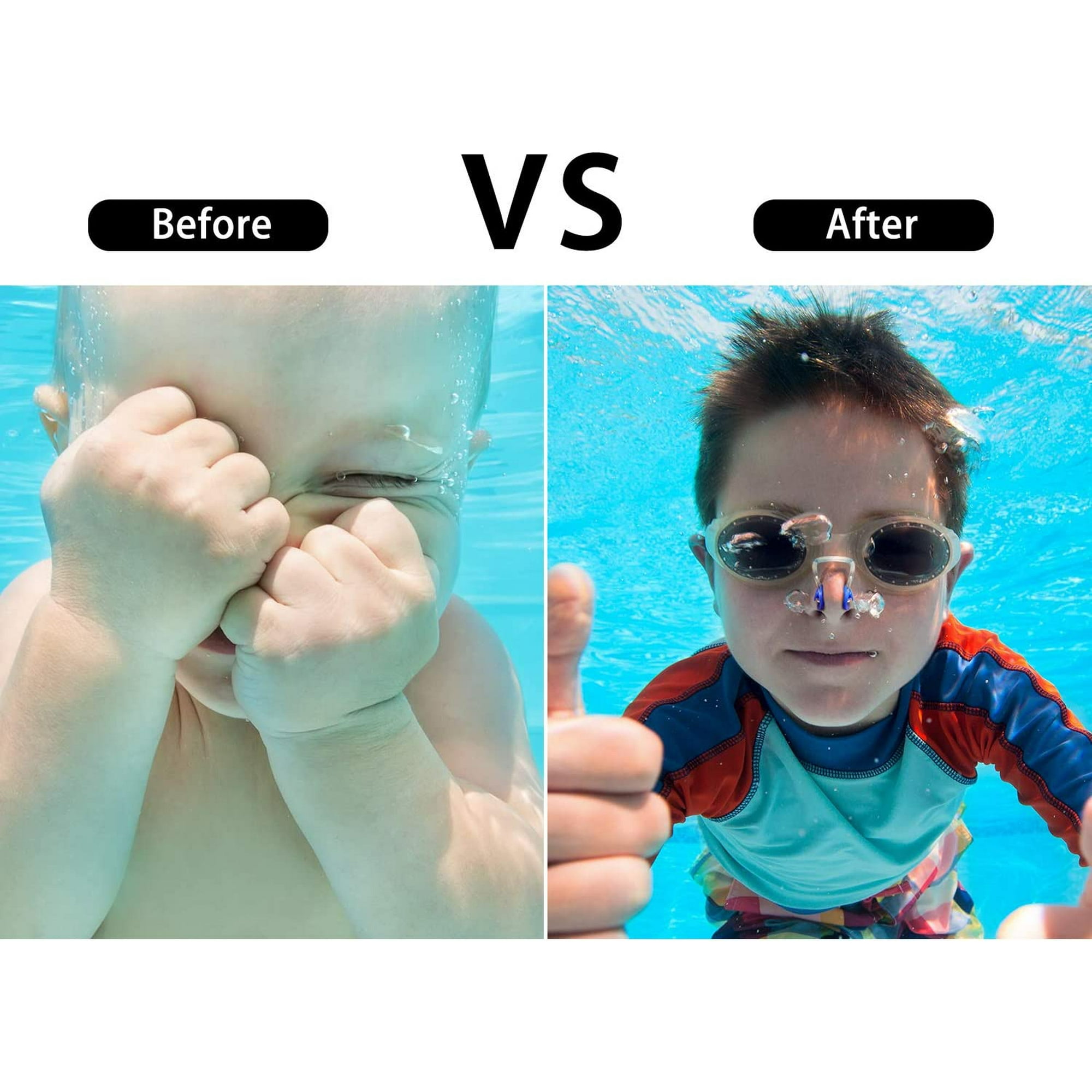 6 Pièces Pince Nez Natation, Pince-Nez En Silicone, Pince-Nez De Natation Protecteur De Nez Imperméable Réutilisable,avec Boîte De Rangement,pour