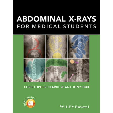Abdominal X-rays for Medical Students - eBook