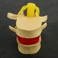 thumbnail image 4 of Modelo De Hernia De Disco Lumbar Humano, Portátil Profesional Práctico 1:1.5 Vértebras Lumbares Humanas Degenerativas, Enseñanza Clínica Para Ortopedia, 4 of 7