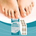 thumbnail image 3 of Parches para el cuidado de las uñas Laniska,1 piezas, 3 of 12
