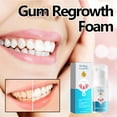 Guoxxzi Gum Treatment Foam, Anti-Inflammatory, Gum Tissue Regeneration ...