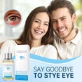 thumbnail image 4 of Stye Eye Treatment Serum Natural Remover with Styes Chalazion and Blepharitis, 1.01 Fl, 4 of 6