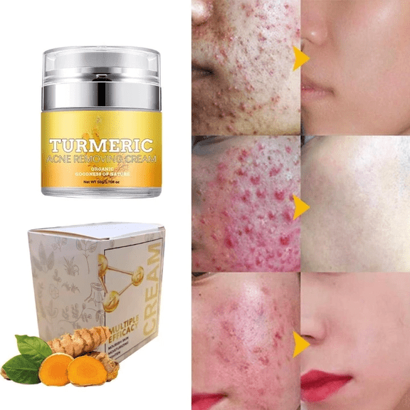 Banzch Turmeric Face Cream For Face & Body -Natural Turmeric Skin Brightening Lotion - Turmeric Cleanses Skin, Fights, Evens Tone, , Sun Damage,Mothers Day Gifts
