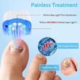 thumbnail image 2 of Dispositivo láser antimicótico para eliminar hongos en las uñas de los dedos de los pies, tratamiento láser para hongos en las uñas, tratamiento casero para onicomicosis, 2 of 4