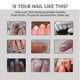 thumbnail image 5 of 2026 3x Efero Nail Exfoliation Plant Nail Repair Fluid Nail Cream Nail Treatment Gel Nail Repair Gel Moisturizing Nail Luster, 5 of 5