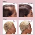 thumbnail image 2 of Hair Growth Supplements for Women, Thicker Fuller Hair Support for Thinning Hair and Hair Loss, 2 of 5