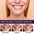 thumbnail image 2 of Purple Tooth Beautifying Toothpaste Niacinamide Whitening Yellow Tooth Remove Stains -, 2 of 5