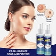 thumbnail image 2 of 2 piezas de spray para eliminar verrugas, tratamiento para verrugas, líquido removedor indoloro de verrugas en la piel, 30 ml, 2 of 4