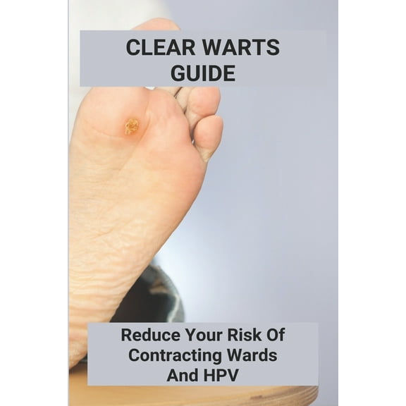 Clear Warts Guide: Reduce Your Risk Of Contracting Wards And Hpv: Does Duct Tape Get Rid Of Warts (Paperback)