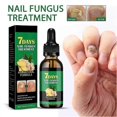 thumbnail image 3 of Ginger Nail Treatment,Multi-Purpose Nail Repair,Nail Nutrient Oil Strengthener Oil Serum Ginger Nail Growth Oil, 3 of 5