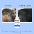 thumbnail image 3 of WishCare Hair Growth Serum Concentrate - 3% Redensyl, 4% Anagain, 2% Baicapil, Caffeine, Biotin, Plant Keratin & Rice Water - Hair Growth Serum for Men & Women, 30 ml, 3 of 4